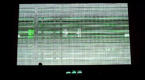SCHNITT - Marco Monfardini - Amelie Duchow - Synchropath live performance at GOGBOT Festival EnshedeSCHNITT - Marco Monfardini - Amelie Duchow - Synchropath live performance at AUDIOVISIVA Festival - Museo della scienza e tecnologia Leonardo da Vinci -  M